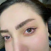 میکروبلیدینگ تتوی بدن