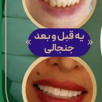 جشنواره کامپوزیت از ۵۹۰|خدمات آرایشگری و زیبایی|اهواز, کیانپارس |دیوار