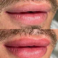 رفع تیرگی لب ،شیدینگ لب ،اسکالپ موی سر آقایون|خدمات آرایشگری و زیبایی|زاهدان, |دیوار