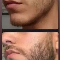 محصولات جدید رویش ریش رسید