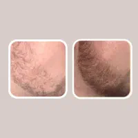 سلامتی|آرایشی، بهداشتی، درمانی|رشت, استادسرا|دیوار
