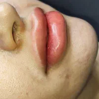 شیدینگ لب|خدمات آرایشگری و زیبایی|کرمانشاه, |دیوار