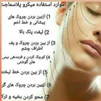 پلاسما جت وخال برداری و