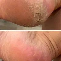 خدمات کف سابی و پدیکور برای اقایان