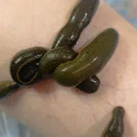 حجامت / زالو درمانی/ بادکش پرستار آقاوخانم باسابقه