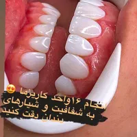 ٪۴۰ تخفیف کامپوزیت دندان اقساط ( بدون سود )|خدمات آرایشگری و زیبایی|شیراز, معالی‌آباد|دیوار
