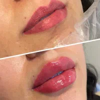 مطبپوست مو لیزر ولاغری|خدمات آرایشگری و زیبایی|مشهد, ایثار|دیوار