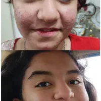 فشیال و پاکسازی تخصصی با مشاوره رایگان