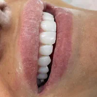 کامپوزیت واحدی ۱/۶۰۰