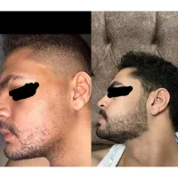 ریشاتو مُکت میکنه