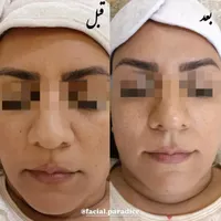 آموزش و پاکسازی و فیشیال تخصصی پوست|خدمات آرایشگری و زیبایی|مشهد, فارغ التحصیلان|دیوار