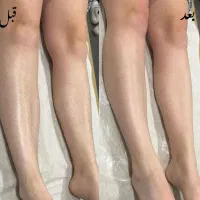 اپیلاسیون و اموزش با مدرک فنی حرفه ای|خدمات آرایشگری و زیبایی|مشهد, گلشور|دیوار