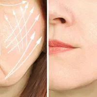 لیفت با نخ|خدمات آرایشگری و زیبایی|اصفهان, باغ زیار|دیوار