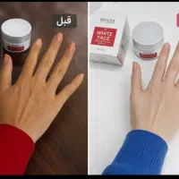 قوی ترین سفید کننده پوست با ضمانت برگشت پول
