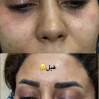 مطب زیبایی در کرمان با ضمانت صد در صد بوتاکس|خدمات آرایشگری و زیبایی|کرمان, |دیوار