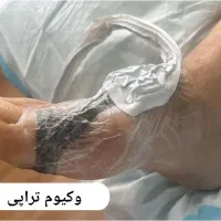 درمان قطعی زخم بستر و زخم دیابتی و زخم های مزمن|خدمات آرایشگری و زیبایی|تهران, هروی|دیوار