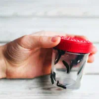 زالو درمانی