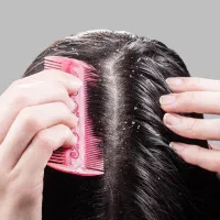 اسکراب اسکالپ( درمان ریزش خارش شوره چربی)