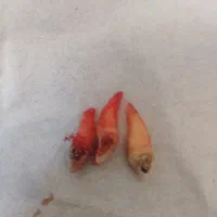 کشیدن دندان های خوی و سلماس|خدمات آرایشگری و زیبایی|خوی, |دیوار