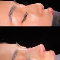 کلیه ی خدمات زیبایی نقد،اقساط در تهران