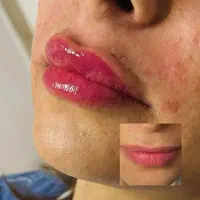 مرکز تخصصی (درمانی-زیبایی) آقایان در شوشتر|خدمات آرایشگری و زیبایی|شوشتر, |دیوار