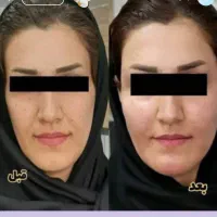 چاقی صورت و بدن تضمینی|خوردنی و آشامیدنی|طبس, |دیوار