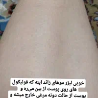 لیزر موهای زائد و پاکسازی صورت فقط 500 تومن|خدمات آرایشگری و زیبایی|اسلام‌شهر, زرافشان|دیوار