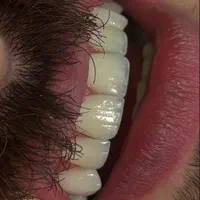 خدمات لمینت و بلچینگ|خدمات آرایشگری و زیبایی|اصفهان, عسگریه|دیوار