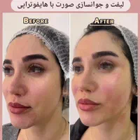 جشنواره تخفیف پلاژن، هایفو، کرایو|خدمات آرایشگری و زیبایی|شیراز, فرهنگ شهر|دیوار