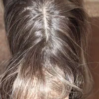 کلاه‌گیس(پوستیژ)|آرایشی، بهداشتی، درمانی|ورامین, ورامین|دیوار