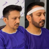 کلینیک تخصصی کاشت|خدمات آرایشگری و زیبایی|پیرانشهر, |دیوار