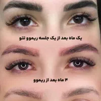 ریمو تخصصی ابرو و چشم و میکروبلیدینگ ابرو