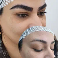 کاشت ابرو vip