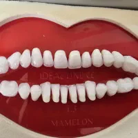 دندان فلکسیبل(ژله‌ای) جایگزین ایمپلنت