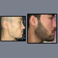 معجون خواص  دار برای رویش