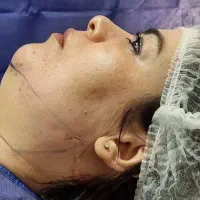 لیپوماتیک آبدو مینو پلاستی پروتز سینه شرایط اقساط|خدمات آرایشگری و زیبایی|تهران, بلوار کشاورز|دیوار
