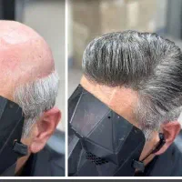 مرکز تخصصی پروتز مو