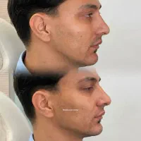 تزریق ژل و بوتاکس و شاین بادی|خدمات زیبایی و سلامت|تبریز, |دیوار