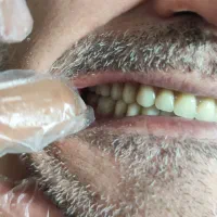 دندانسازی دندان مصنوعی|خدمات آرایشگری و زیبایی|نیشابور, امام خمینی|دیوار