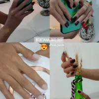 کاشت ناخن