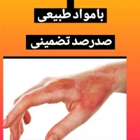 پماد سوختگی