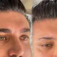 میکرو ابرو اقاییون و بن مژه و اسکالپ