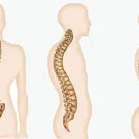 کلینیک ارتوپدی درمان قوز،گودی کمر و دردهای کمر