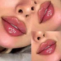جشنواره 2روزه ژل وبوتاکس آنزیم ومزو