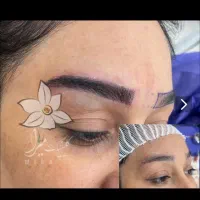 کاشت ابرو رایگان