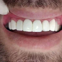 دستیار  دندانپزشک
