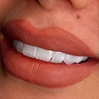 تخفیفات پاییزی کلینیک دیاموند|خدمات آرایشگری و زیبایی|زرندیه, |دیوار