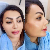 تخفیف ویژه زیبا جویان ژل ۴۰۰بوتاکس۳۰۰فقط یک هفته|خدمات آرایشگری و زیبایی|اصفهان, شهشهان|دیوار