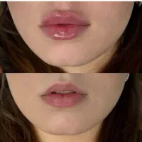 جراحی و زیبایی توسط پزشک متخصص|خدمات آرایشگری و زیبایی|تهران, قیطریه|دیوار