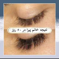 مژه ها و ابروهات رو تقویت و زیبا کن|خدمات آرایشگری و زیبایی|اهواز, گلستان|دیوار